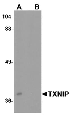 BATF3 Antibody - BSA Free, Novus Biologicals:Antibodies:Primary Antibodies